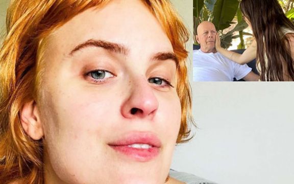 Tallulah Willis: Autizam i dermatolomanija - Životna borba ćerke Demi Moore i Bruce Willisa!